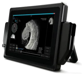 VuPad Portable Ophthalmic Ultrasound